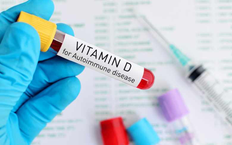 Enfermedades Autoinmunes y Vitamina D