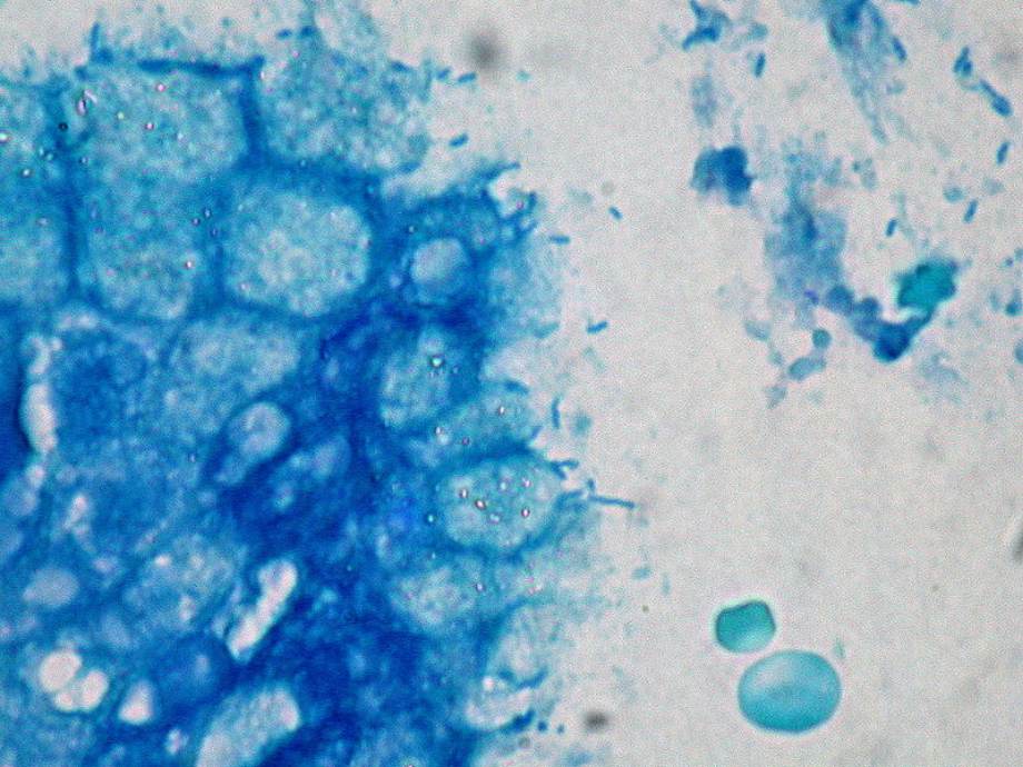 Helicobacter pylori: Enfermedades asociadas