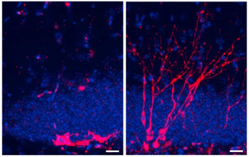 Cuál es la importancia de la neurogénesis, para qué sirve la neurogénesis