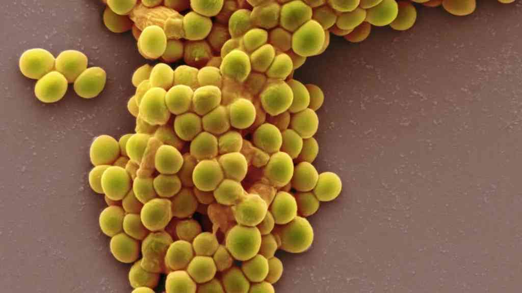 Beneficios del Streptococcus thermophilus