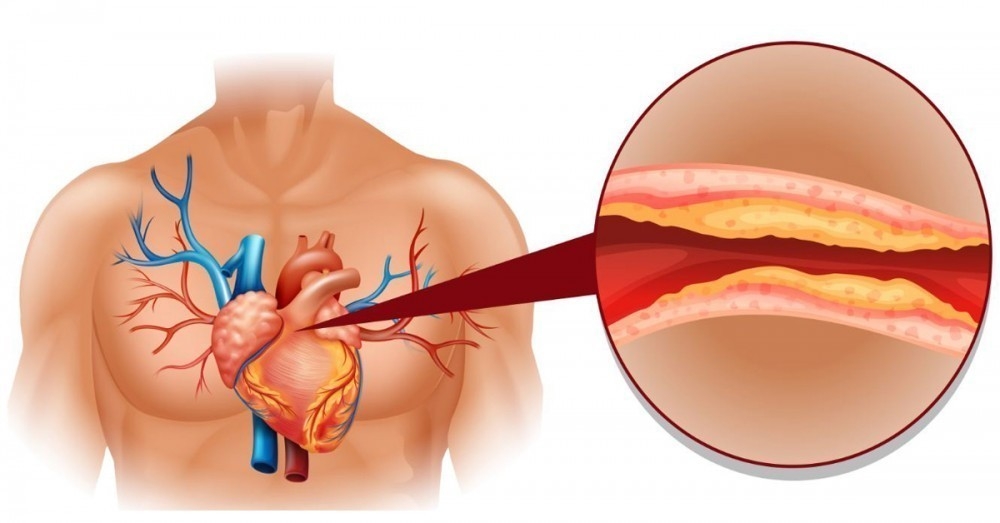 colesterol venas vascular