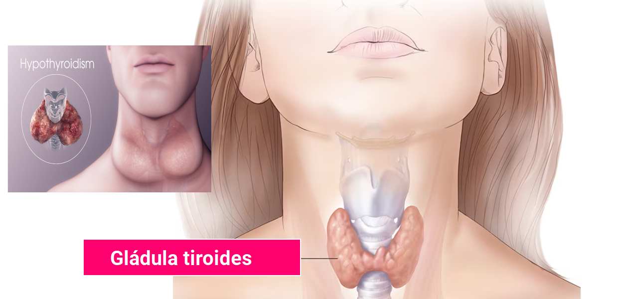 Hipotiroidismo: ¿qué es? causas, síntomas y tratamiento