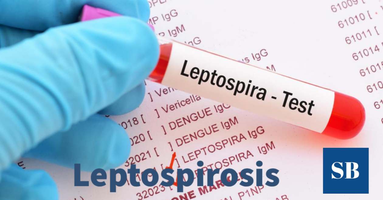 Leptospirosis (en humanos): factores, síntomas, diagnóstico y tratamiento