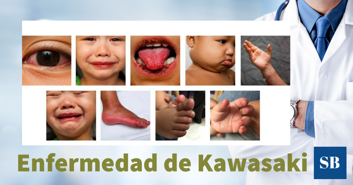 Enfermedad de Kawasaki: causas y síntomas de esta condición que afecta a niños